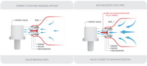 Alternative view of OTWO Smart-Bag Adult blástursbelgur