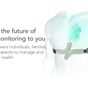 Alternative view of QardioCore EKG